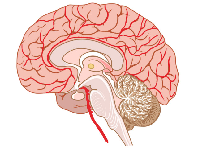 脳の血管の問題による頭痛